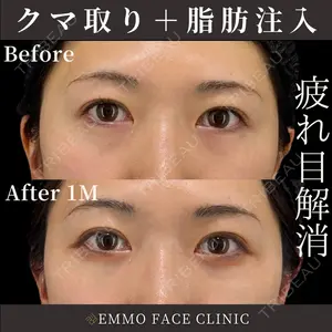 EMMO FACE CLINIC 東京三田院 木之下 哲彦医師の症例