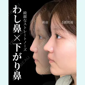 症例