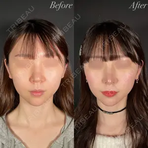 R Beauty CLINIC 大阪院 小池 泰弘医師の症例