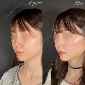 R Beauty CLINIC 大阪院 小池 泰弘医師の症例