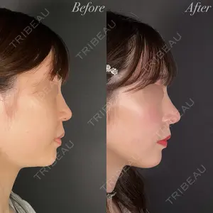 R Beauty CLINIC 大阪院 小池 泰弘医師の症例