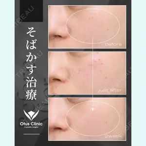 症例