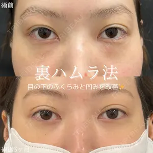 ルラ美容クリニック 仙台院 橋本 英樹医師の症例