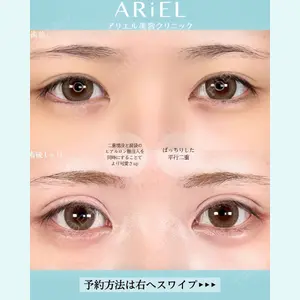 アリエル美容クリニック 大宮院 鈴木　桂介医師の症例
