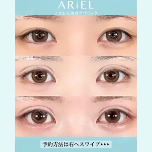 アリエル美容クリニック 大宮院 鈴木　桂介医師の症例
