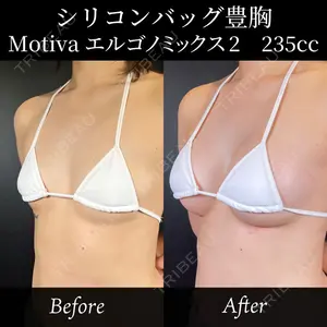 症例