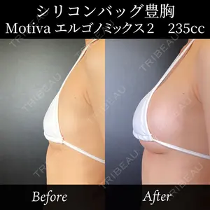 症例