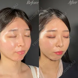 R Beauty CLINIC 名古屋院 木村 尚大医師の症例