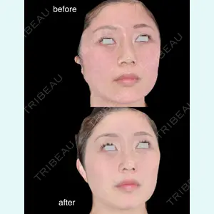 ARIEL.BUST.CLINIC 石塚 紀行医師の症例