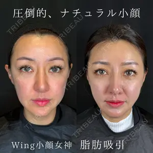 症例