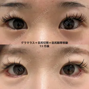 エターナル美容クリニック 久門田 詳医師の症例