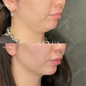 NEXUS CLINIC 冨岡 紗友里医師の症例