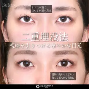 東京形成美容外科 船橋院 弓削田　浩主医師の症例