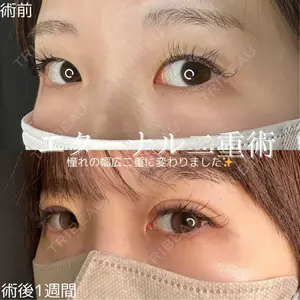 ルラ美容クリニック 仙台院 橋本 英樹医師の症例