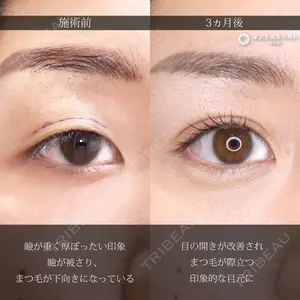 東京形成美容外科 船橋院 弓削田　浩主医師の症例