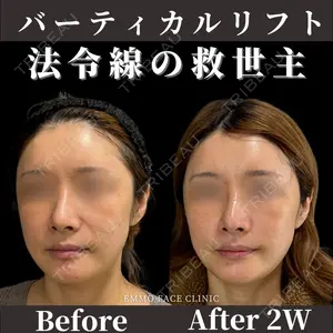 EMMO FACE CLINIC 東京三田院 木之下 哲彦医師の症例