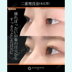 東京形成美容外科 船橋院 山田 大輔医師の症例