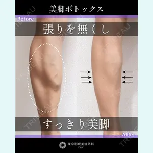 東京形成美容外科 銀座院 中尾 真紀医師の症例