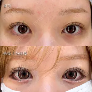 HAAB×DREAM BEAUTY CLINIC 東京本院 萩原 昂医師の症例