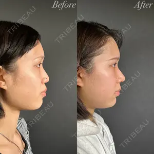 R Beauty CLINIC 名古屋院 木村 尚大医師の症例
