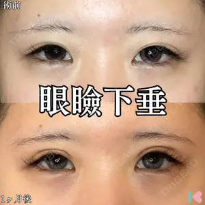 形成外科と美容外科のクリニック池袋 春日 航医師の症例
