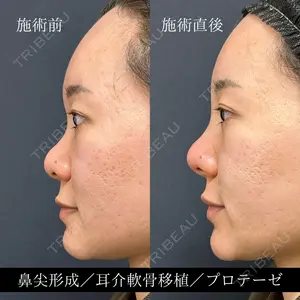 症例