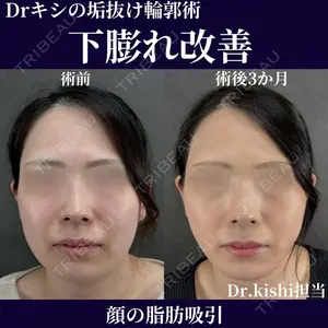 ネビュラクリニック 京都院 岸 大輔医師の症例