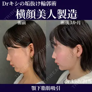 ネビュラクリニック 京都院 岸 大輔医師の症例