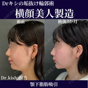 ネビュラクリニック 京都院 岸 大輔医師の症例