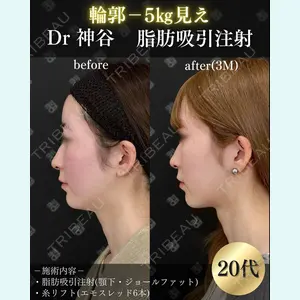 EMMO FACE CLINIC 大阪梅田院 神谷 一成医師の症例