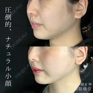 症例