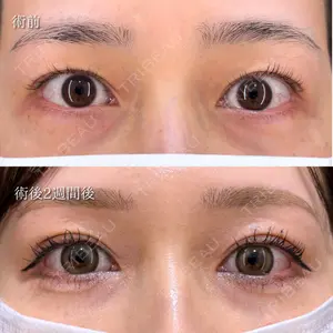 HAAB×DREAM BEAUTY CLINIC 東京本院 萩原 昂医師の症例