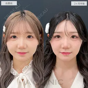 A CLINIC（エークリニック） 銀座院 中原 良介医師の症例