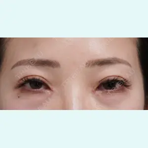 症例