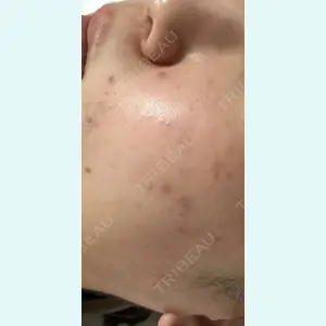 しんゆり美容健康クリニックの症例