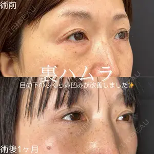 ルラ美容クリニック 仙台院 橋本 英樹医師の症例