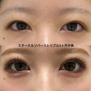 エターナル美容クリニック 久門田 詳医師の症例