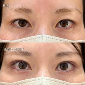 HAAB×DREAM BEAUTY CLINIC 東京本院 萩原 昂医師の症例