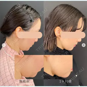 自由が丘ウェルエイジングビューティークリニックの症例