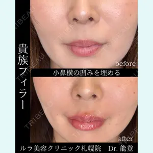 ルラ美容クリニック 札幌院 能登 貴弘医師の症例