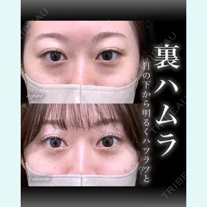 EMMO FACE CLINIC 大宮院 百瀬 直也医師の症例