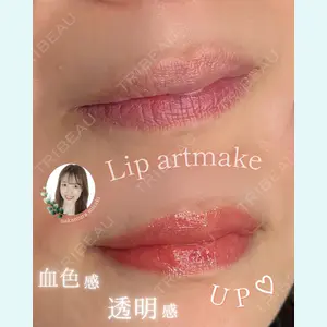 症例