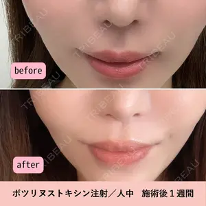 ジュエルクリニック 恵比寿院の症例