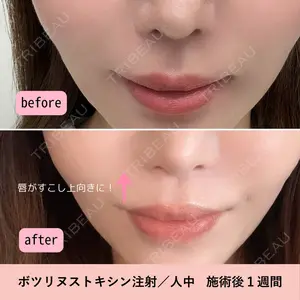 ジュエルクリニック 恵比寿院の症例