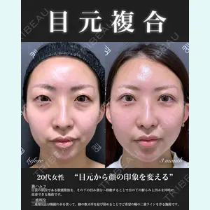 EMMO FACE CLINIC 大宮院 百瀬 直也医師の症例