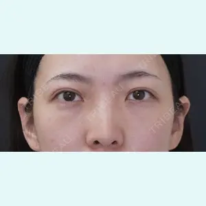 症例