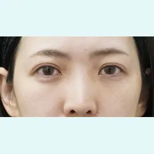 症例