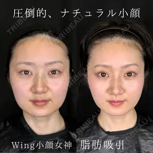 症例