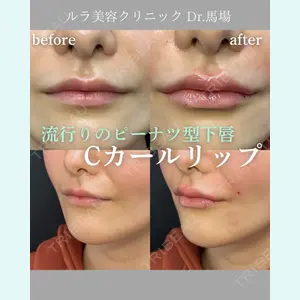 ルラ美容クリニック 名古屋本院 馬場 愛理医師の症例
