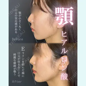 ルラ美容クリニック 大宮院 右京 大季医師の症例